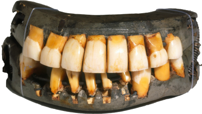 From the Collection: George Washington's Only Remaining Set of Dentures
